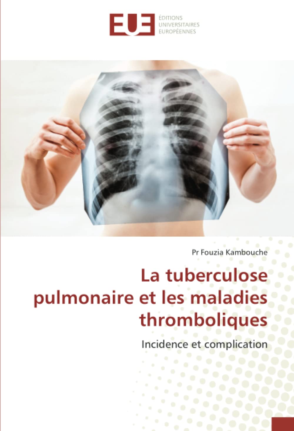 La tuberculose pulmonaire et les maladies thromboliques: Incidence et complication book