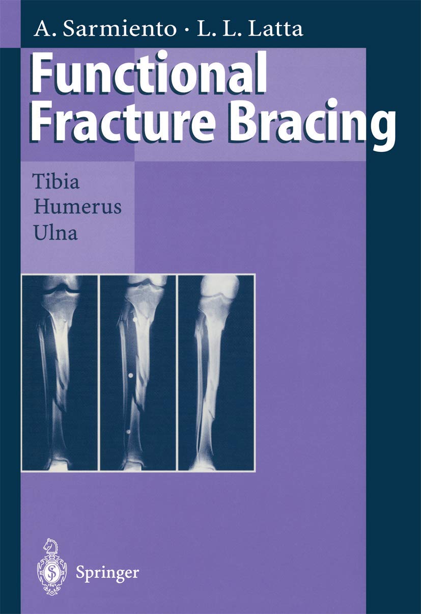 Product Image: Functional Fracture Bracing: Tibia, Humerus, and Ulna