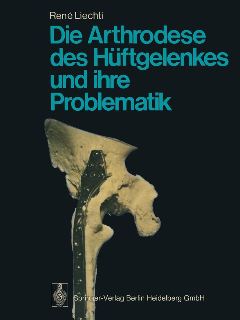 Die Arthrodese des Hüftgelenkes und ihre Problematik Medicine