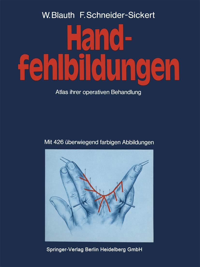 Handfehlbildungen: Atlas ihrer operativen Behandlung Medicine