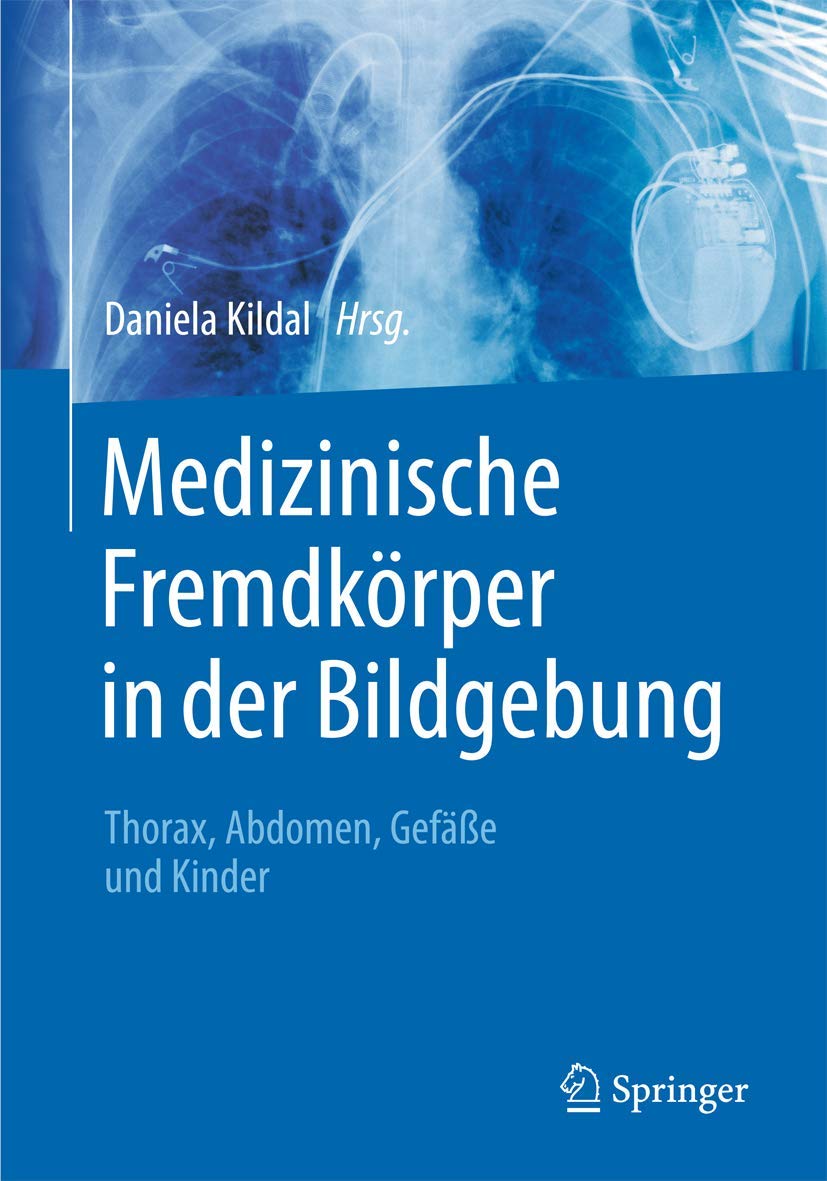 Medizinische Fremdkörper in der Bildgebung Medicine