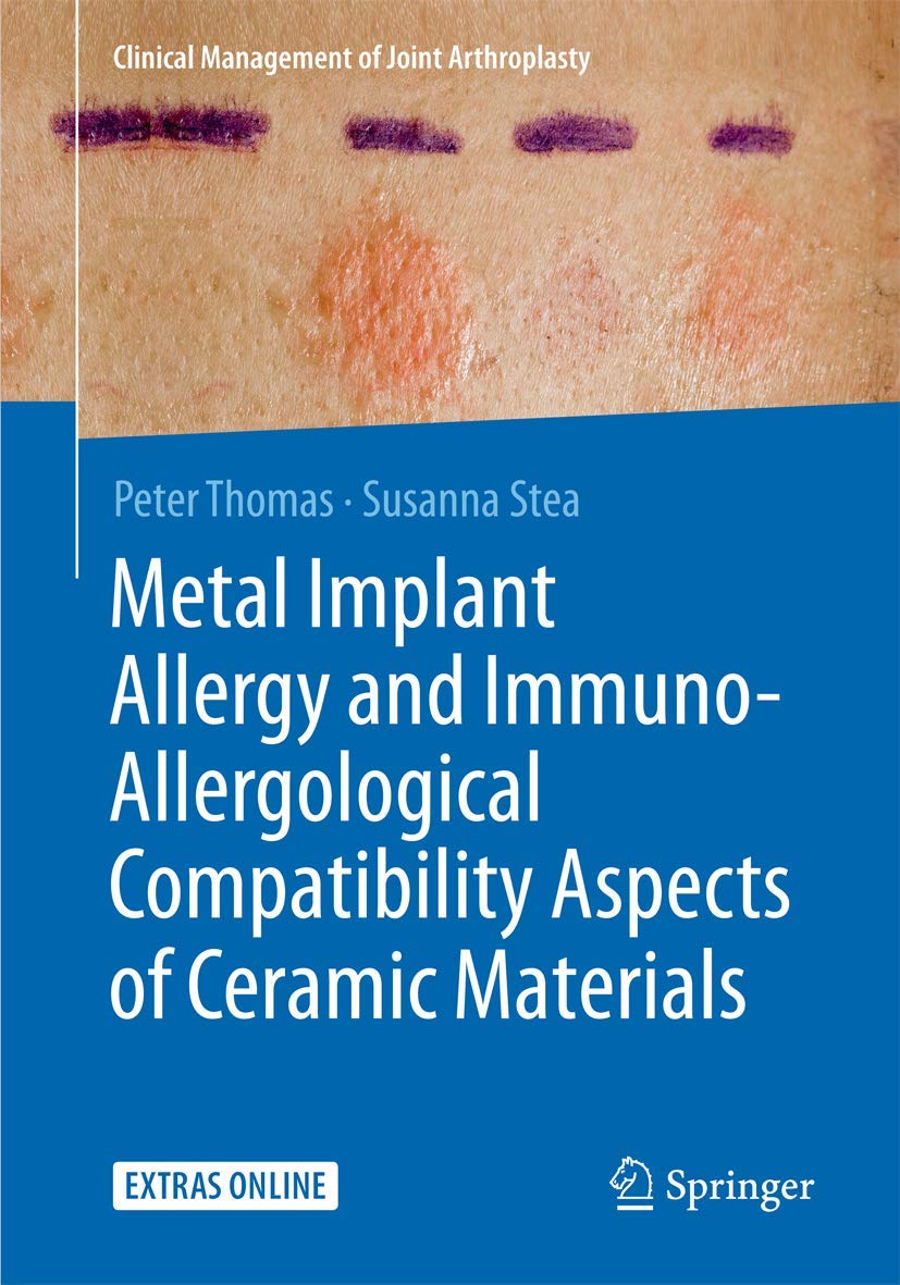 Metal Implant Allergy and Immuno-Allergological Compatibility Aspects of Ceramic Materials Medicine