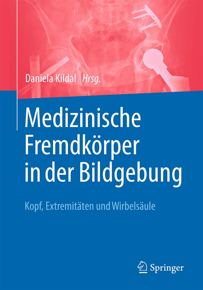 Medizinische Fremdkörper in der Bildgebung: Kopf, Extremitäten und Wirbelsäule Medicine