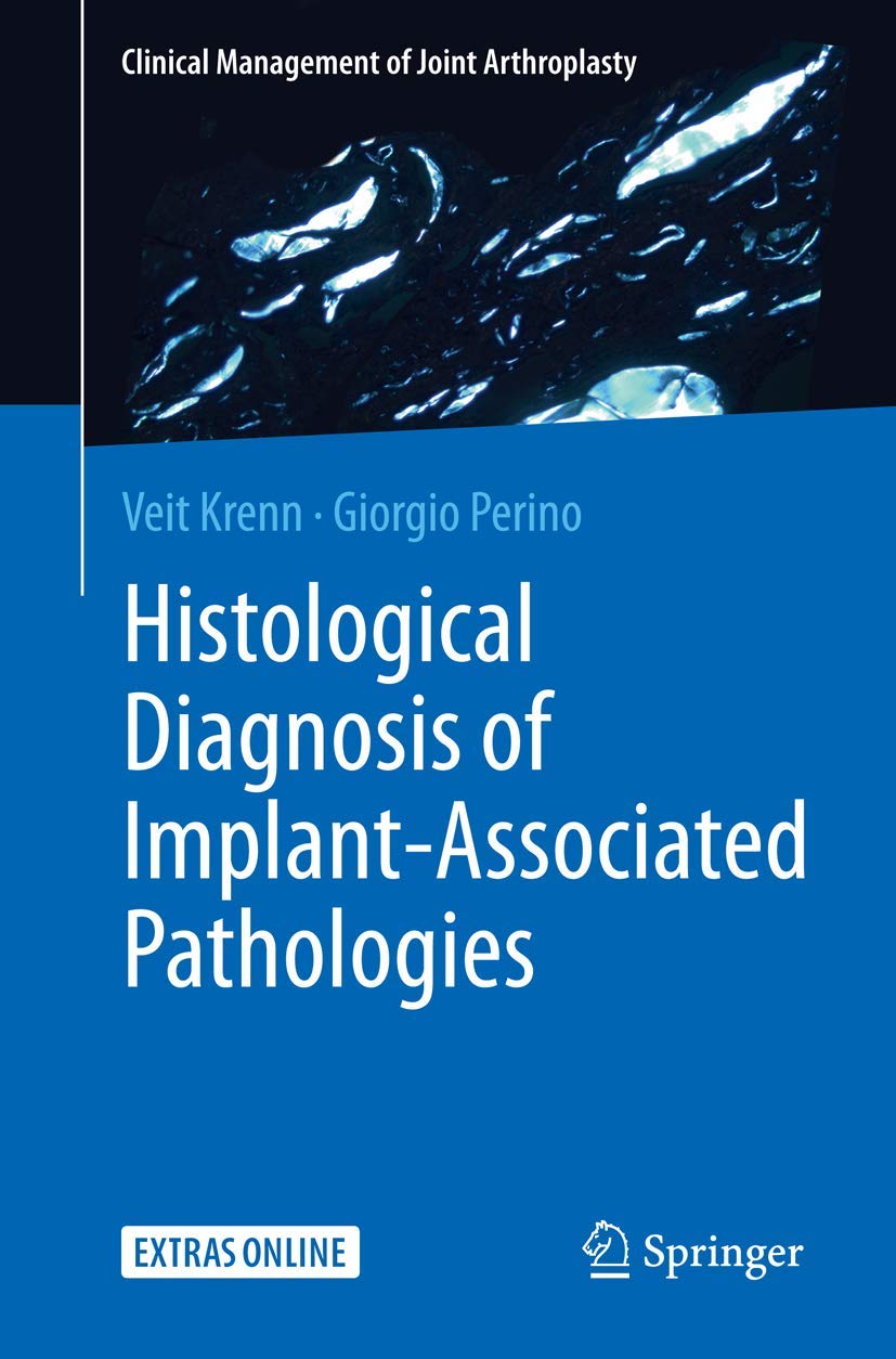 Histological Diagnosis of Implant-associated Pathologies Medicine