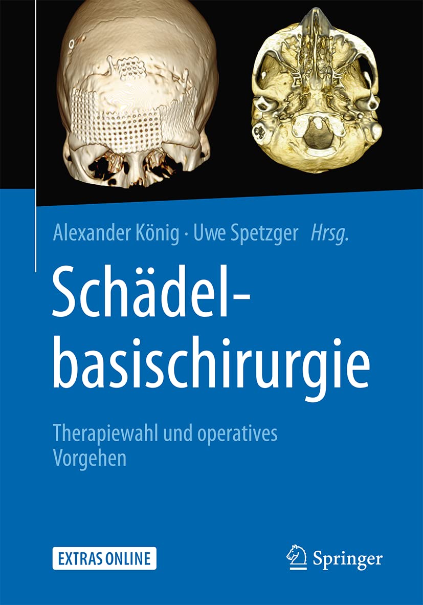 Schädelbasischirurgie: Therapiewahl Und Operatives Vorgehen book
