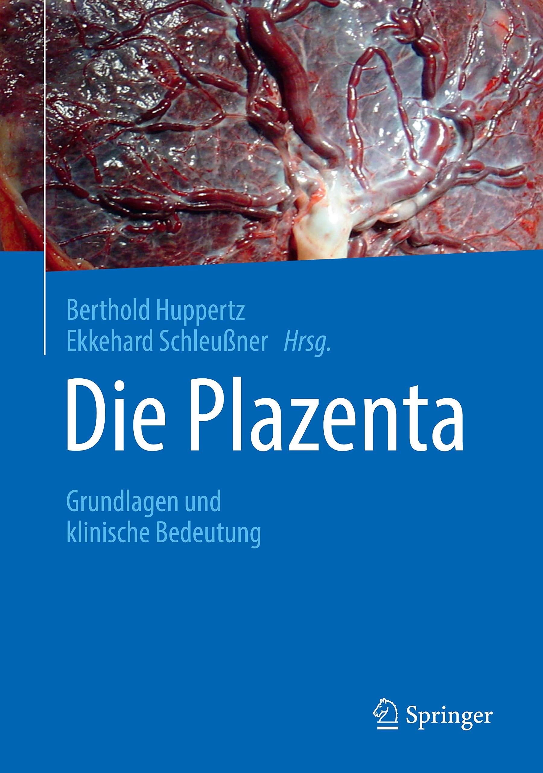 Die Plazenta: Grundlagen und klinische Bedeutung Medicine