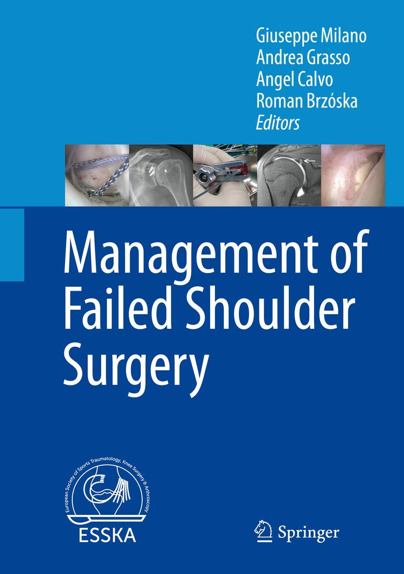 Management of Failed Shoulder Surgery book