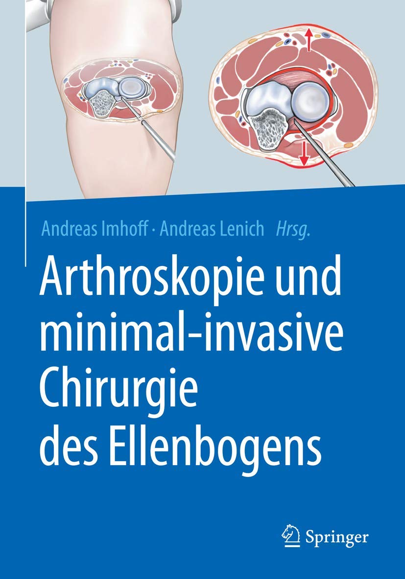 Arthroskopie und minimal-invasive Chirurgie des Ellenbogens Medicine