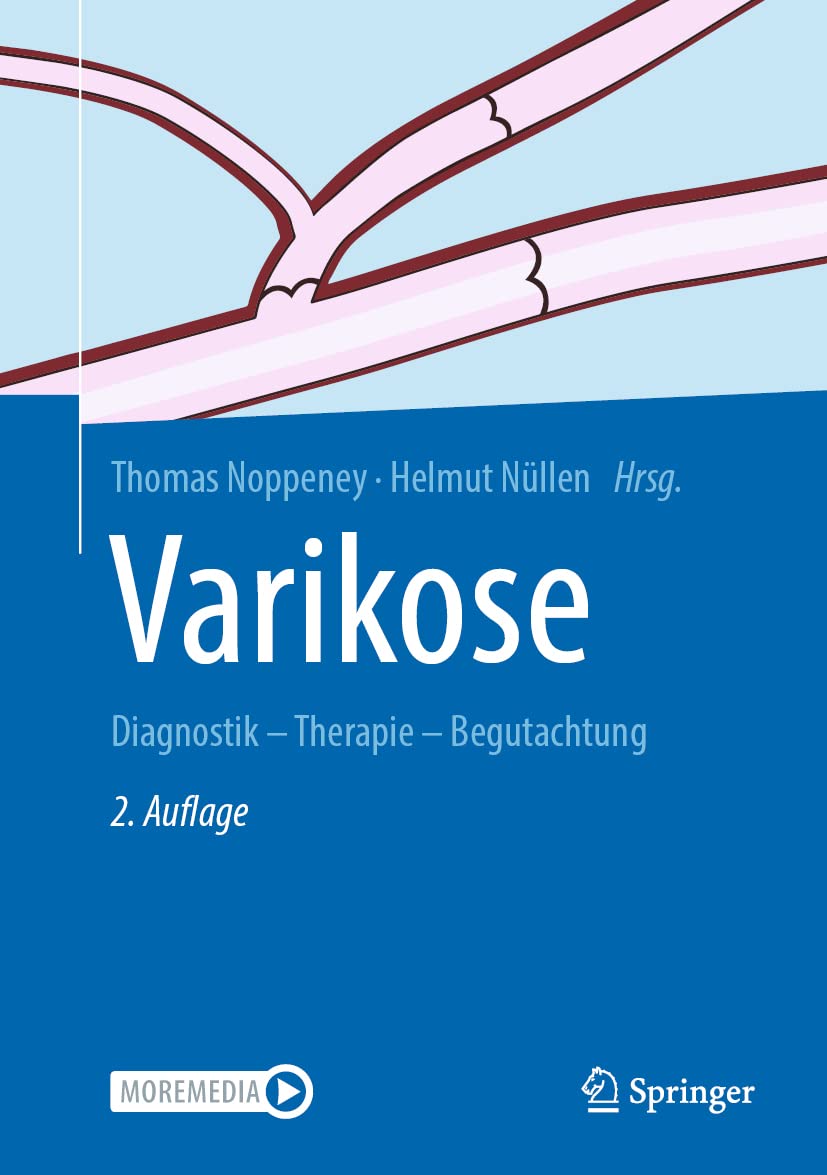 Varikose Medicine