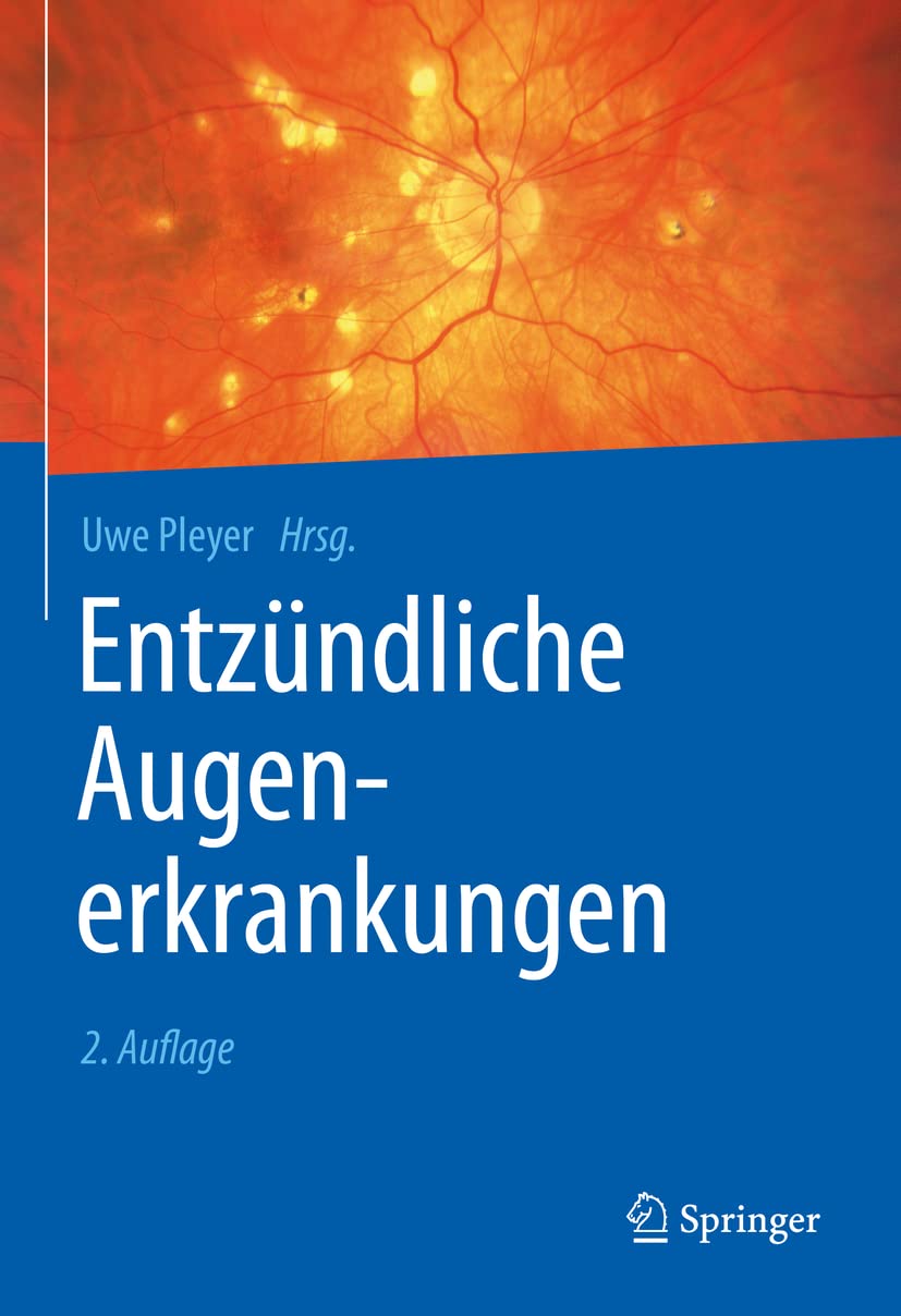 Entzündliche Augenerkrankungen Medicine