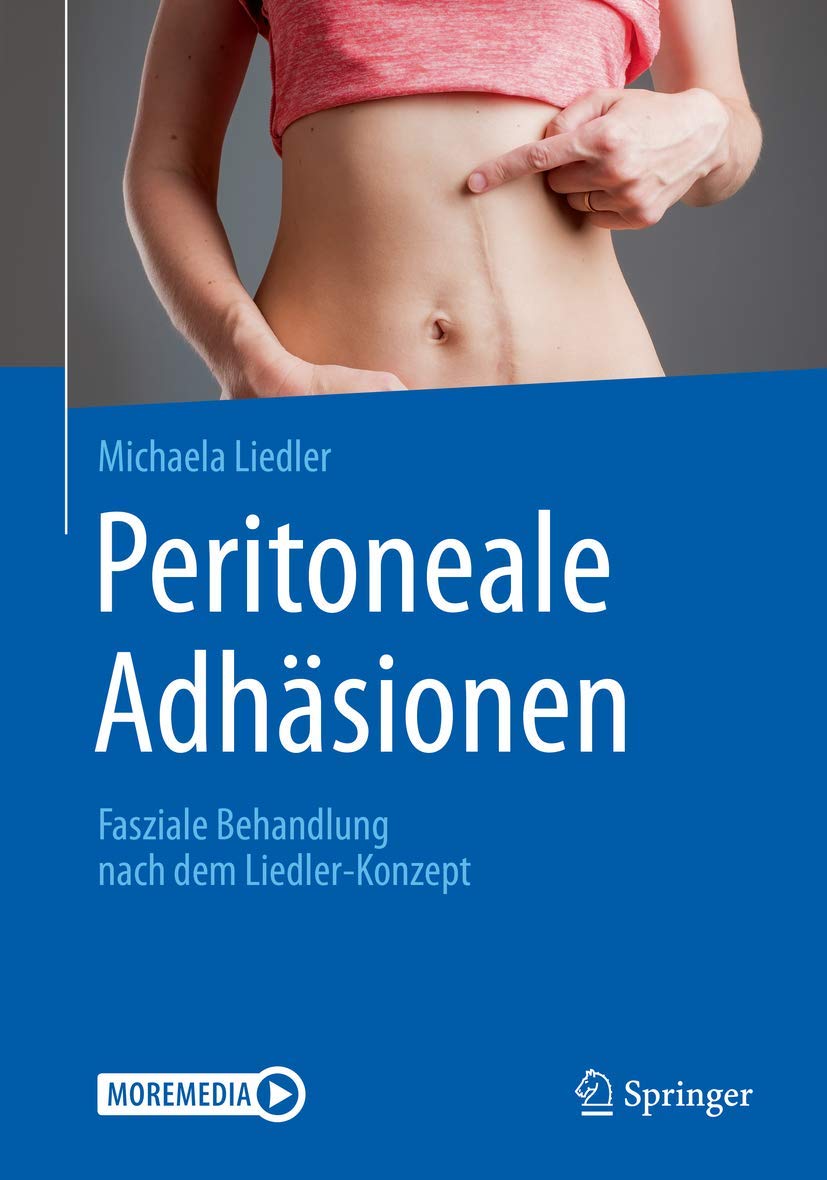 Peritoneale Adhäsionen: Fasziale Behandlung nach dem Liedler-Konzept Medicine