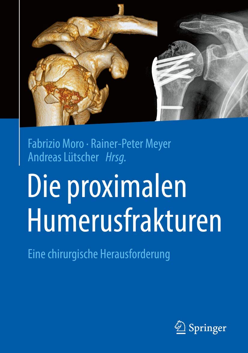 Die proximalen Humerusfrakturen: Eine chirurgische Herausforderung Medicine