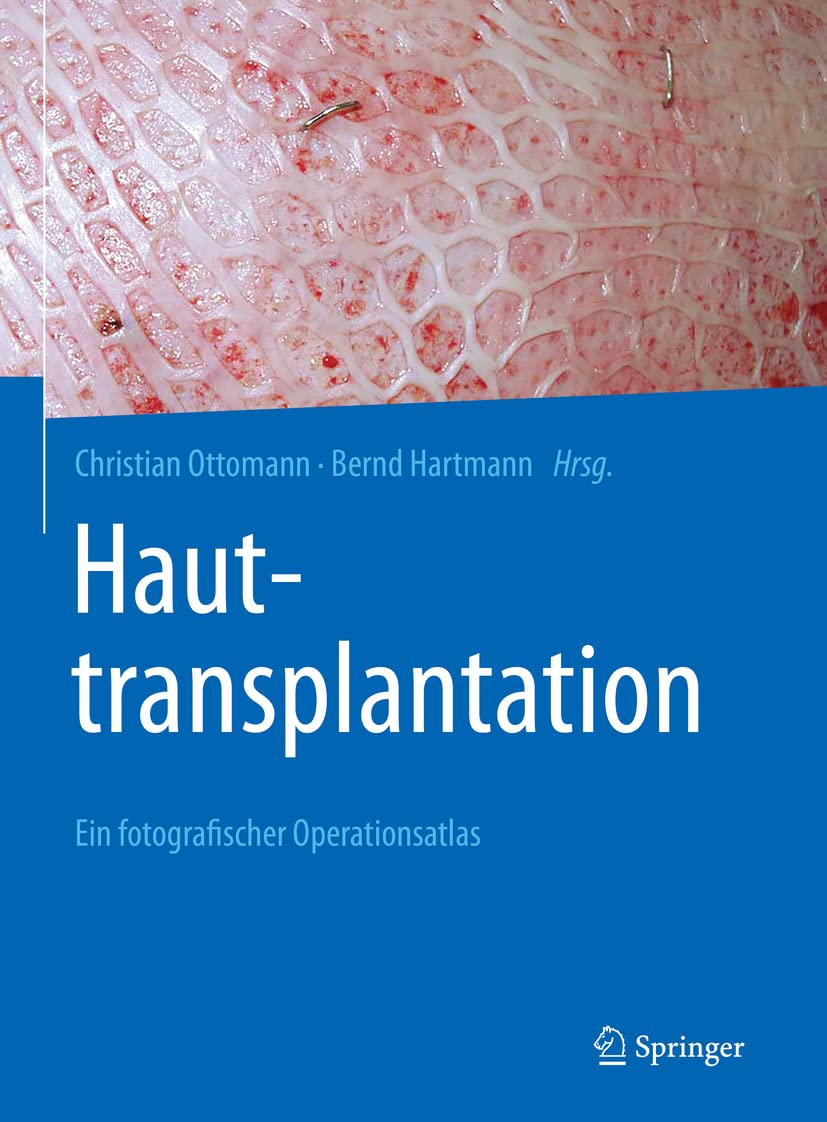 Product Image: Hauttransplantation