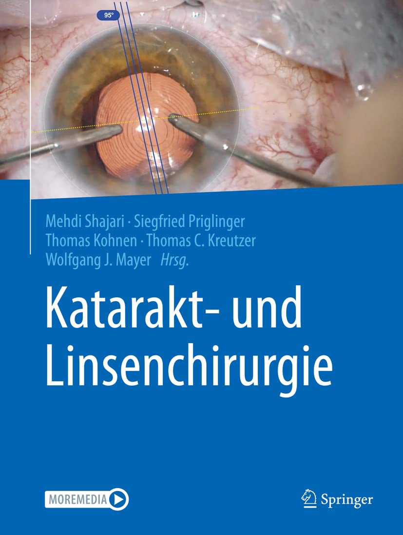 Product Image: Katarakt- und Linsenchirurgie