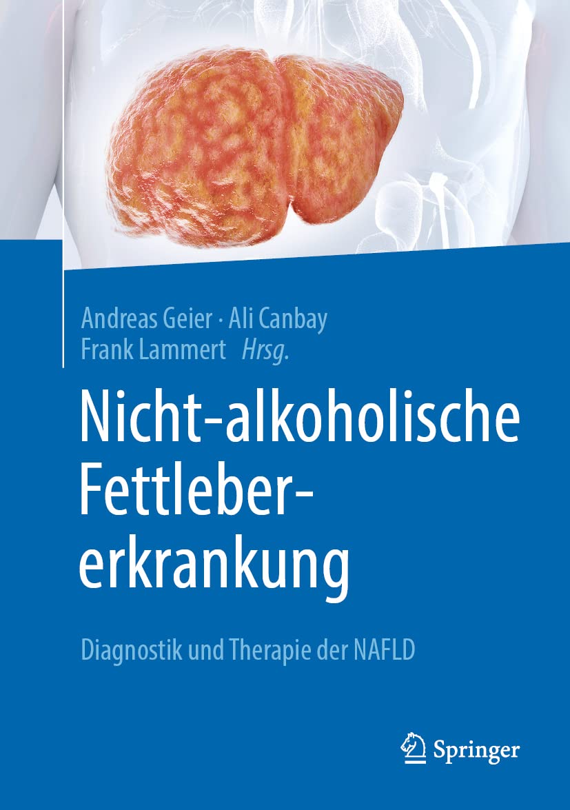 Nicht-alkoholische Fettlebererkrankung: Diagnostik und Therapie der NAFLD Medicine