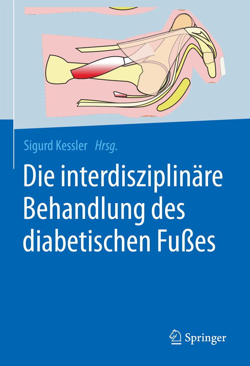 Die interdisziplinäre Behandlung des diabetischen Fußes Medicine
