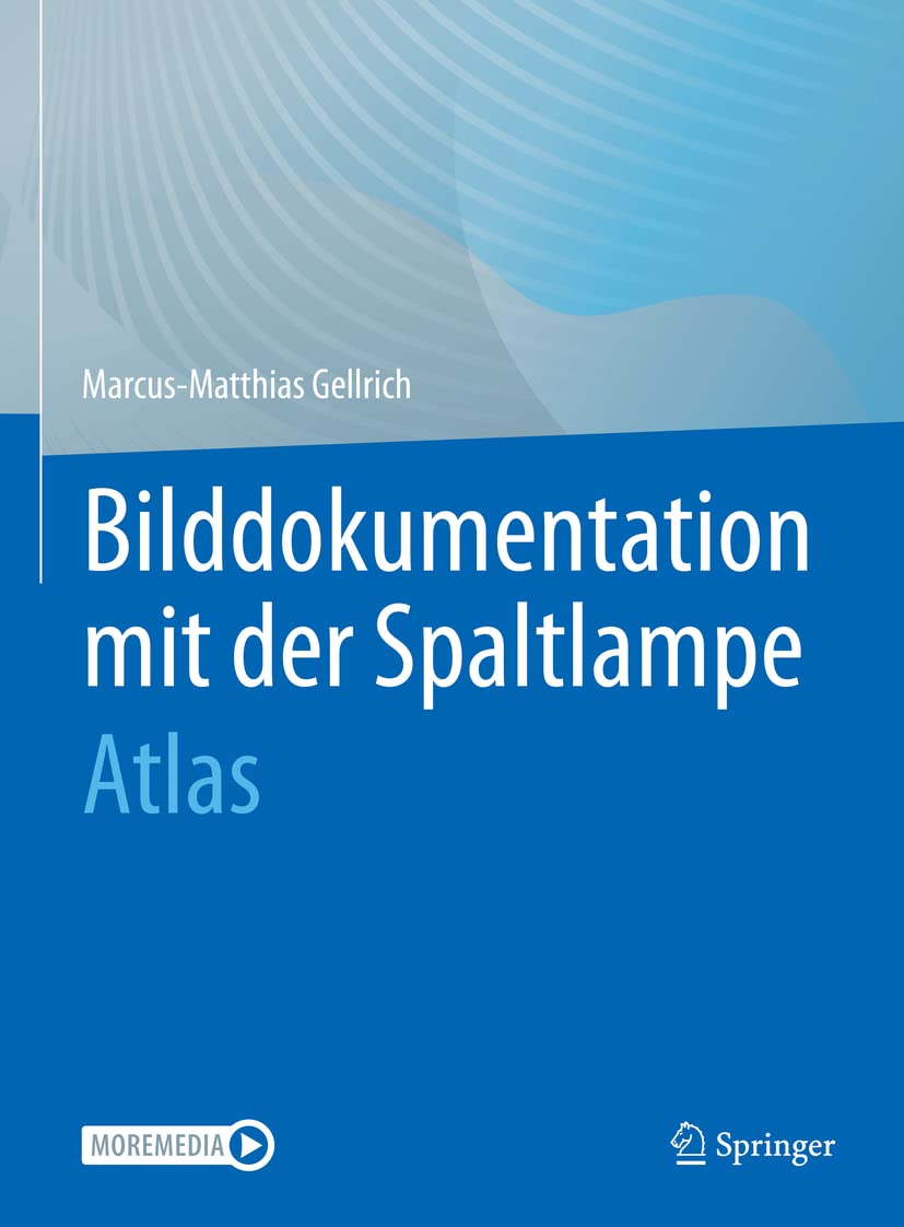 Product Image: Bilddokumentation mit der Spaltlampe
