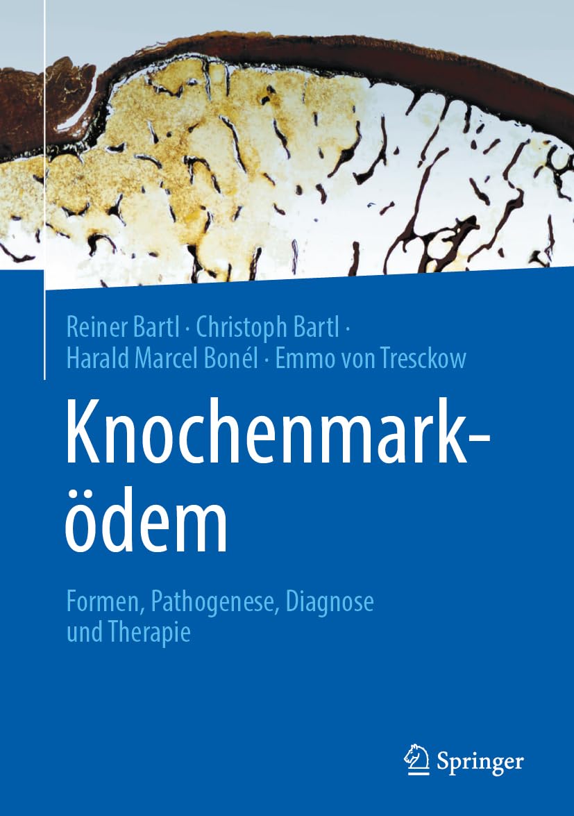 Product Image: Knochenmarködem: Formen, Pathogenese, Diagnose und Therapie