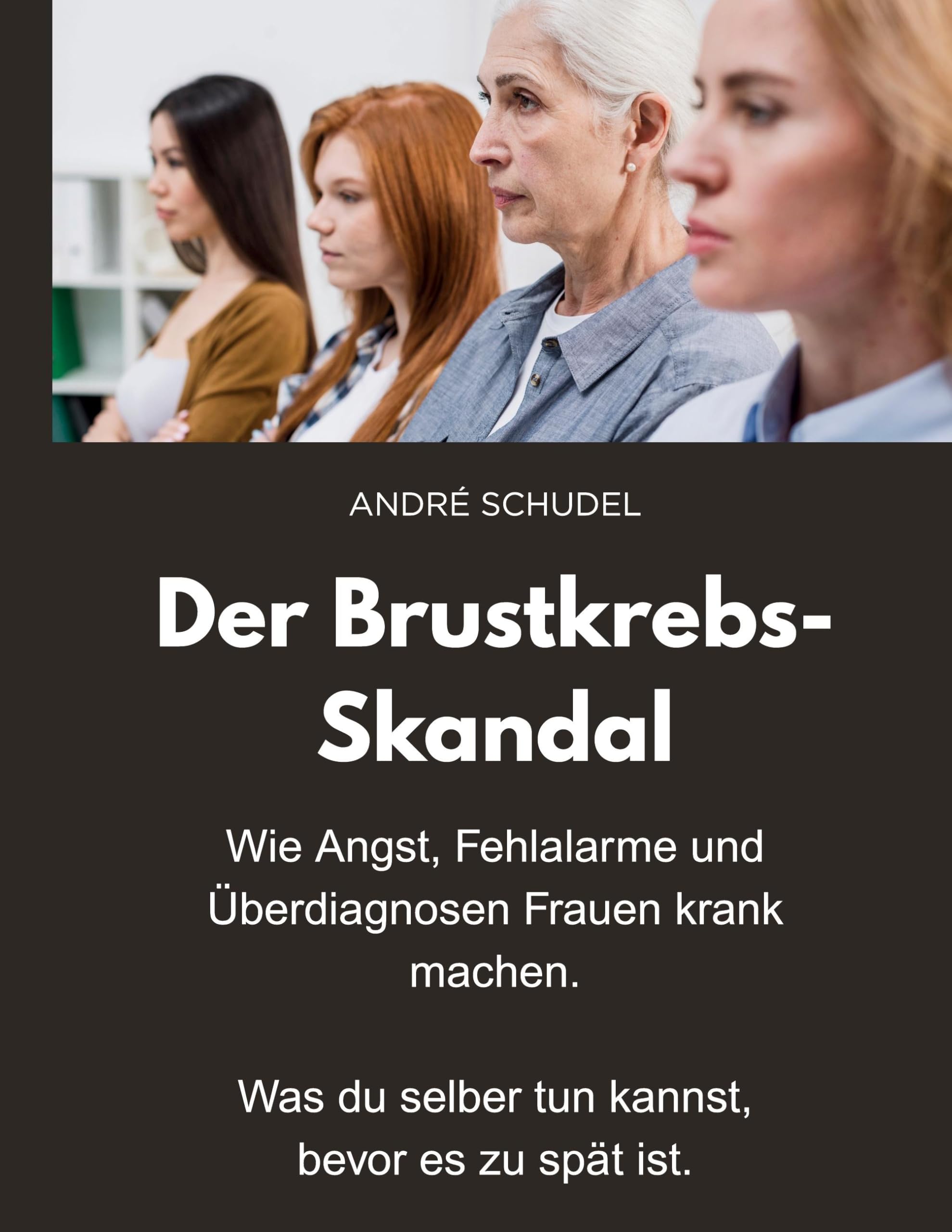 Der Brustkrebs-Skandal - Wie Angst, Fehlalarme und Überdiagnosen Frauen krank machen - Was du selber tun kannst, bevor es zu spät ist. Medicine