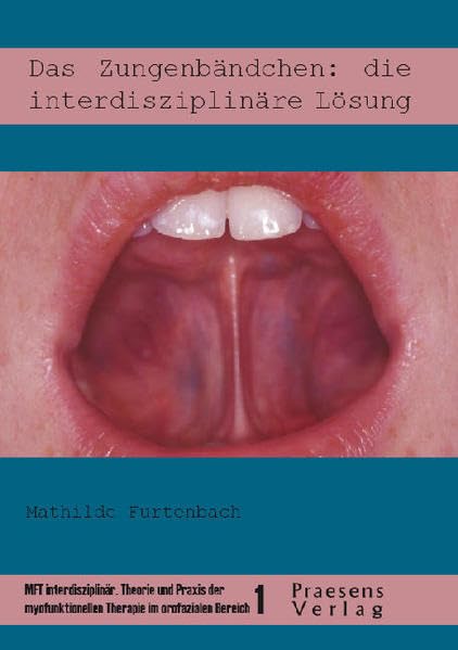 Das Zungenbändchen: die interdisziplinäre Lösung Medicine