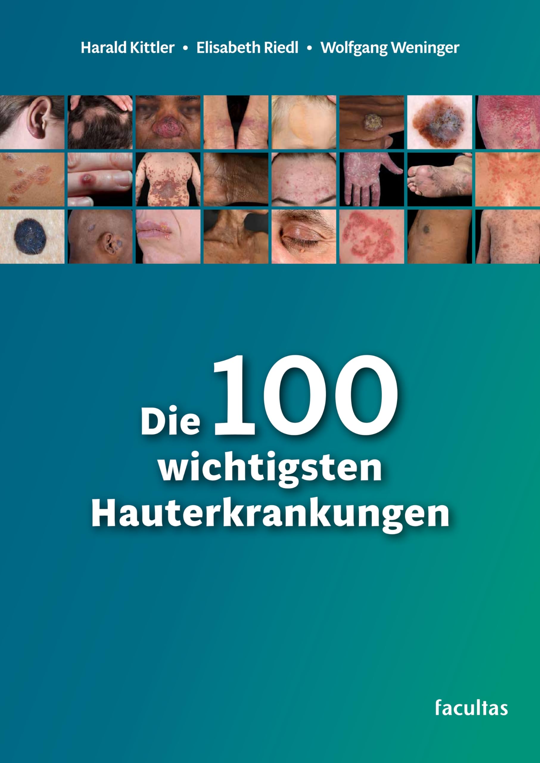 Die 100 wichtigsten Hauterkrankungen Medicine