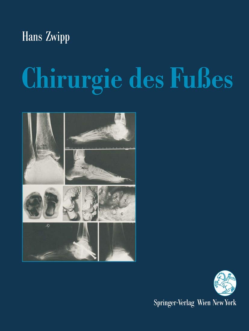 Chirurgie des Fußes Medicine