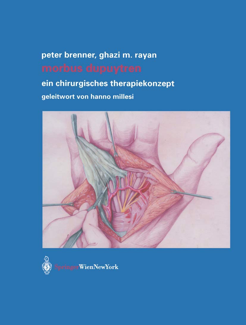 Morbus Dupuytren: Ein chirurgisches Therapiekonzept Medicine