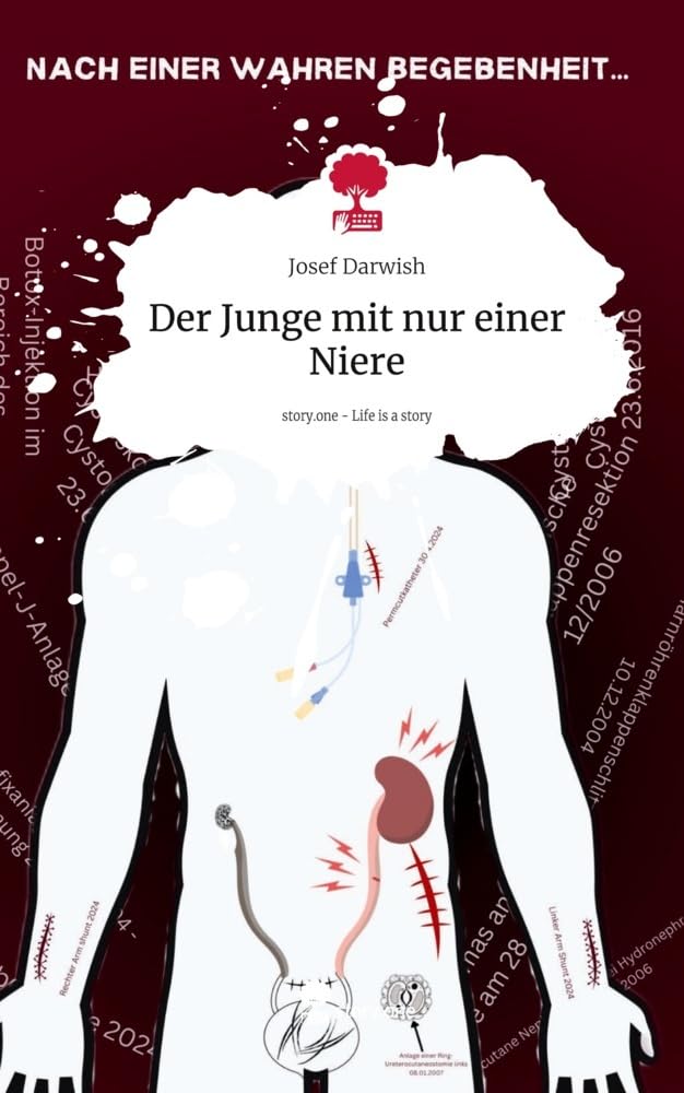 Der Junge mit nur einer Niere. Life is a Story - story.one Contemporary literature