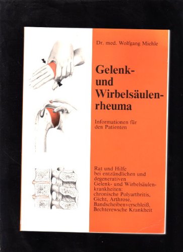 Gelenk- und Wirbelsäulenrheuma. Informationen für den Patienten. Rat und Hilfe bei entzündlichen und degenerativen Gelenk- und Wirbelsäulenkrankheiten: chronische Polyarthritis, Gicht, Arthrose, Bandscheibenverschleiß, Bechterewsche Krankheit. Books