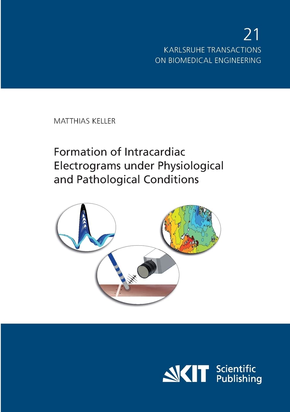Formation of Intracardiac Electrograms under Physiological and Pathological Conditions Business & Technology