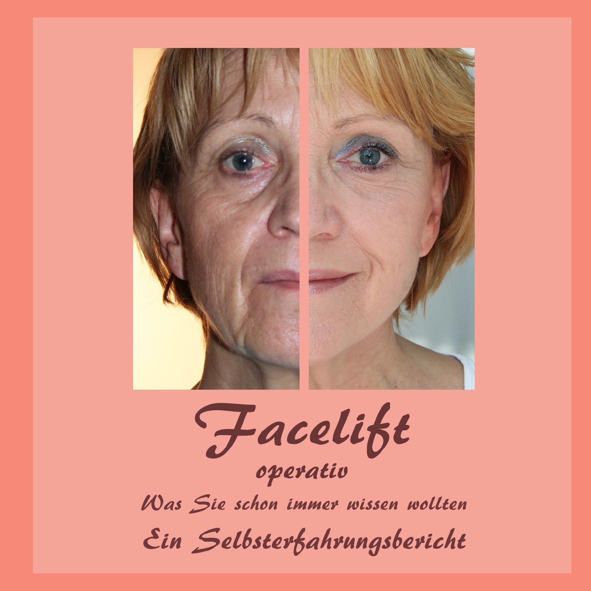 Product Image: Facelift operativ