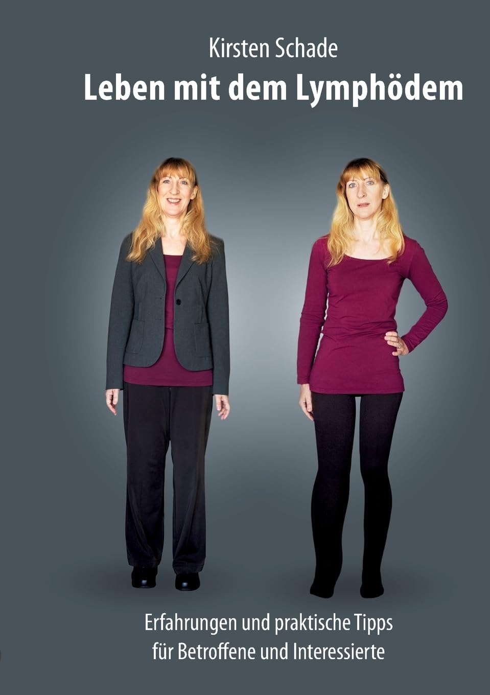 Product Image: Leben mit dem Lymphödem
