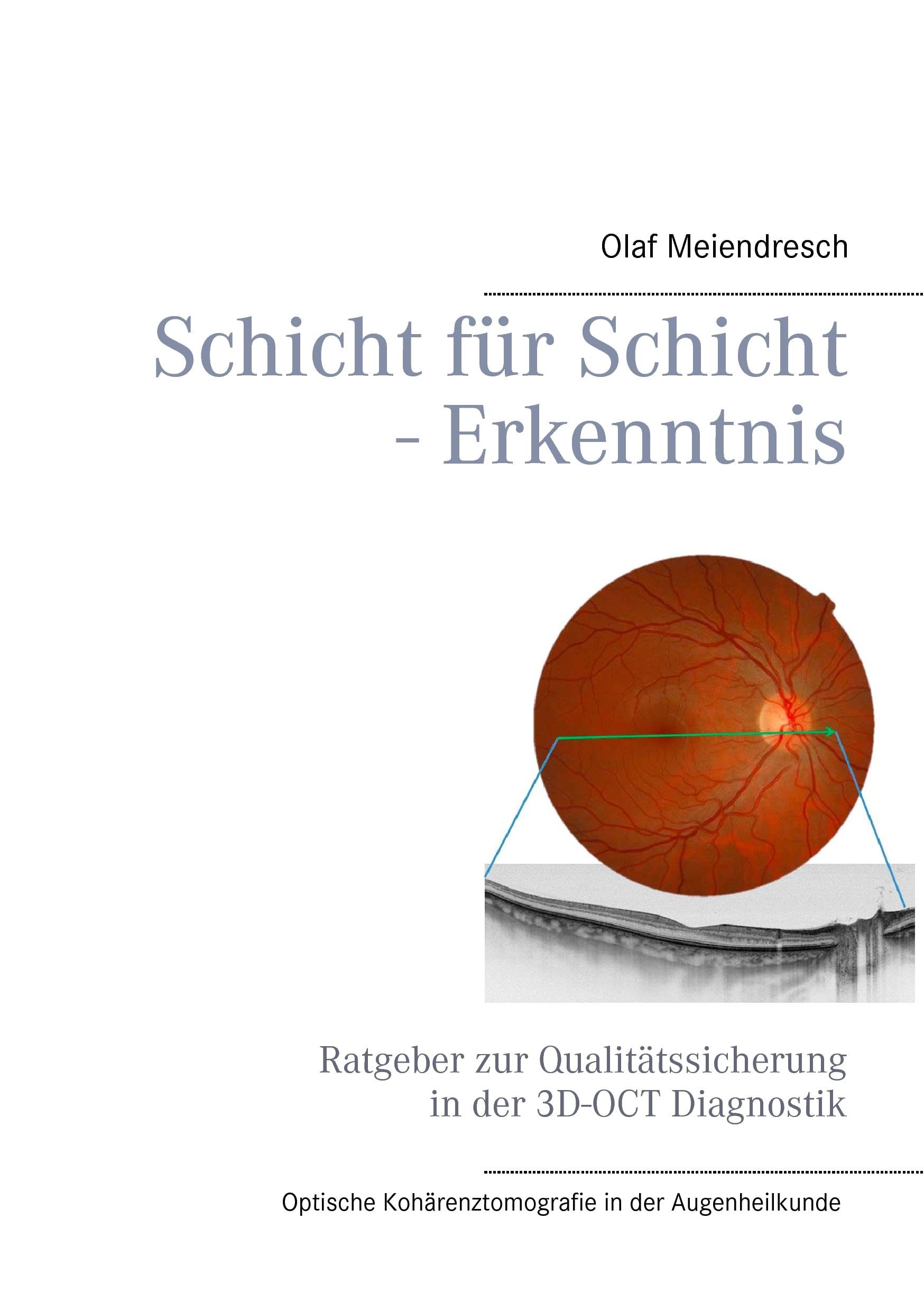 Schicht für Schicht - Erkenntnis: Ratgeber zur Qualitätssicherung in der 3D-OCT Diagnostik Medicine