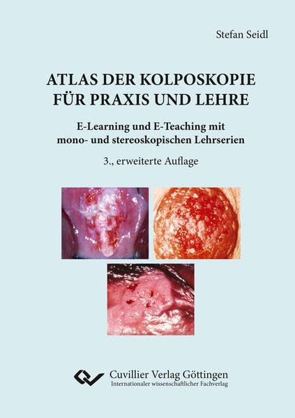 Atlas der Kolposkopie für Praxis und Lehre: E-Learning und E-Teaching mit mono- und stereoskopischen Lehrserien Medicine