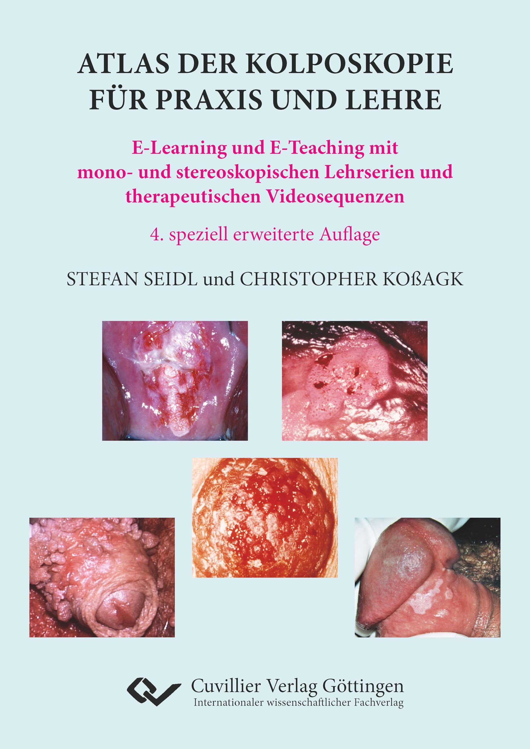 Atlas der Kolposkopie für Praxis und Lehre. E-Learning und E-Teaching mit mono- und stereoskopischen Lehrserien und therapeutischen Videosequenzen Medicine