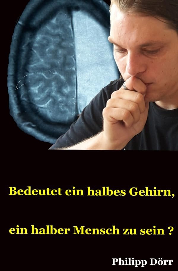 Bedeutet ein halbes Gehirn, ein halber Mensch zu sein? Personalities