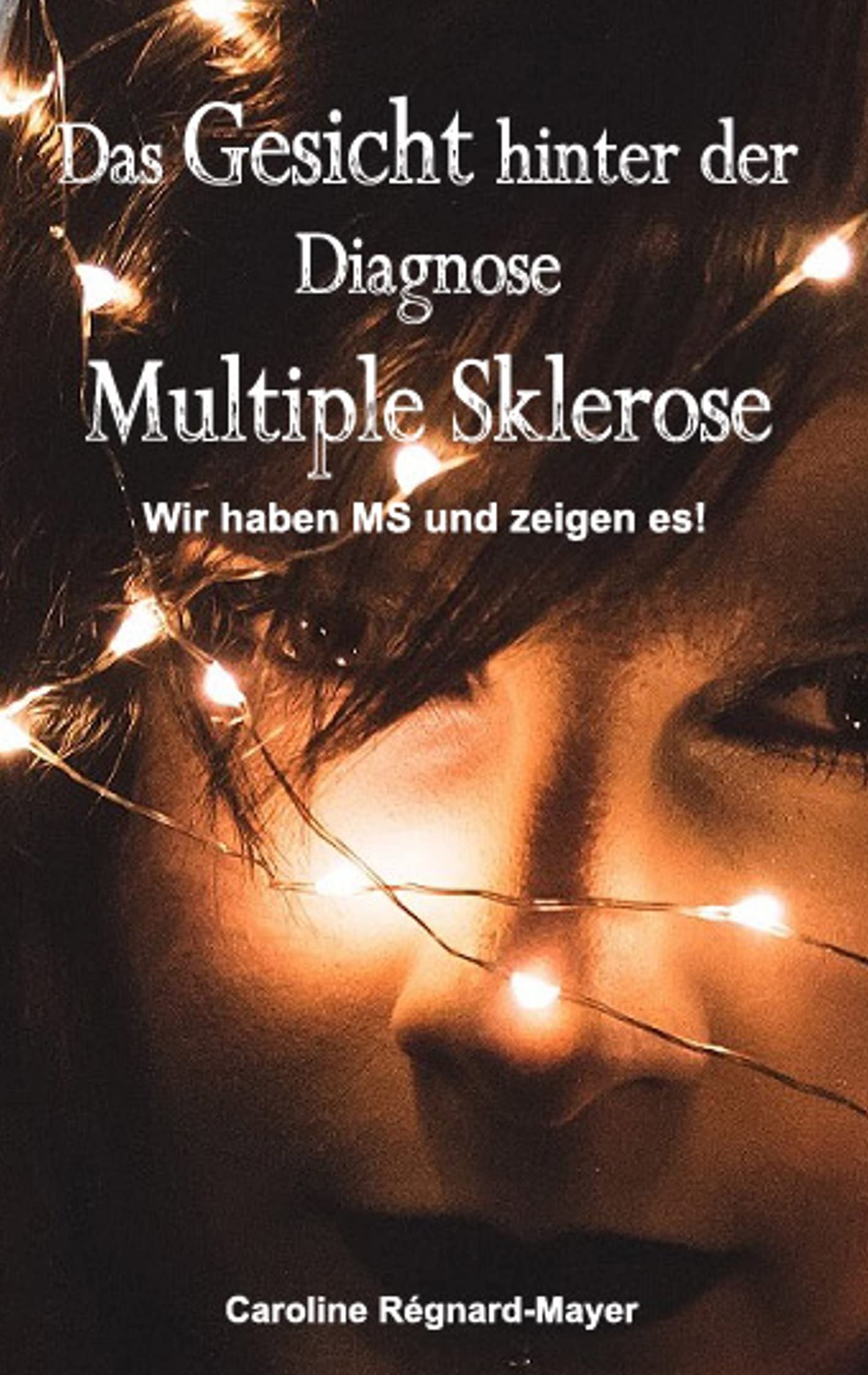 Das Gesicht hinter der Diagnose Multiple Sklerose: Wir haben MS und zeigen es! Medicine
