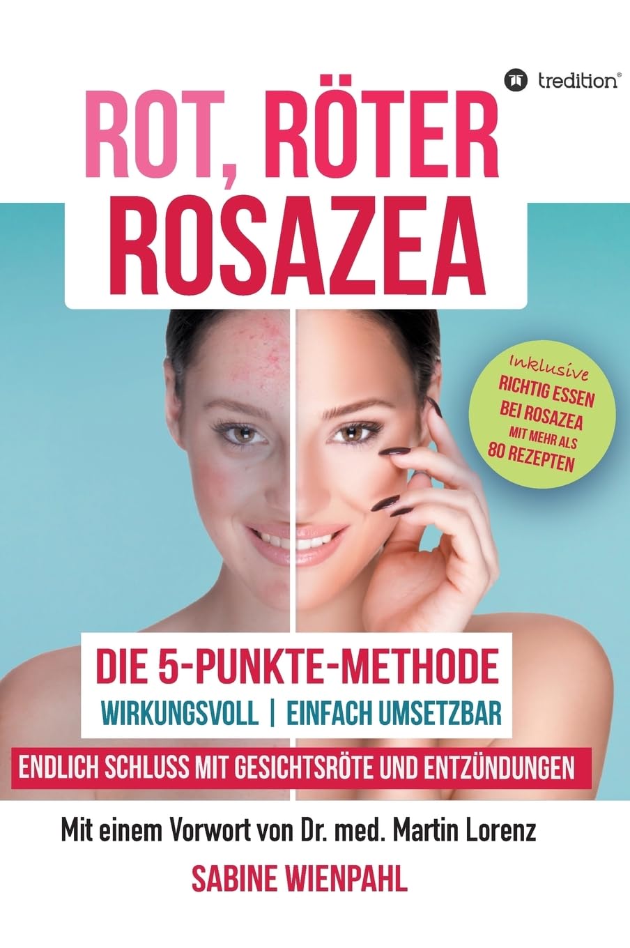 ROT RÖTER ROSAZEA: Die "5-Punkte-Methode" – Endlich Schluss mit Gesichtsröte und Entzündungen Parents & Children