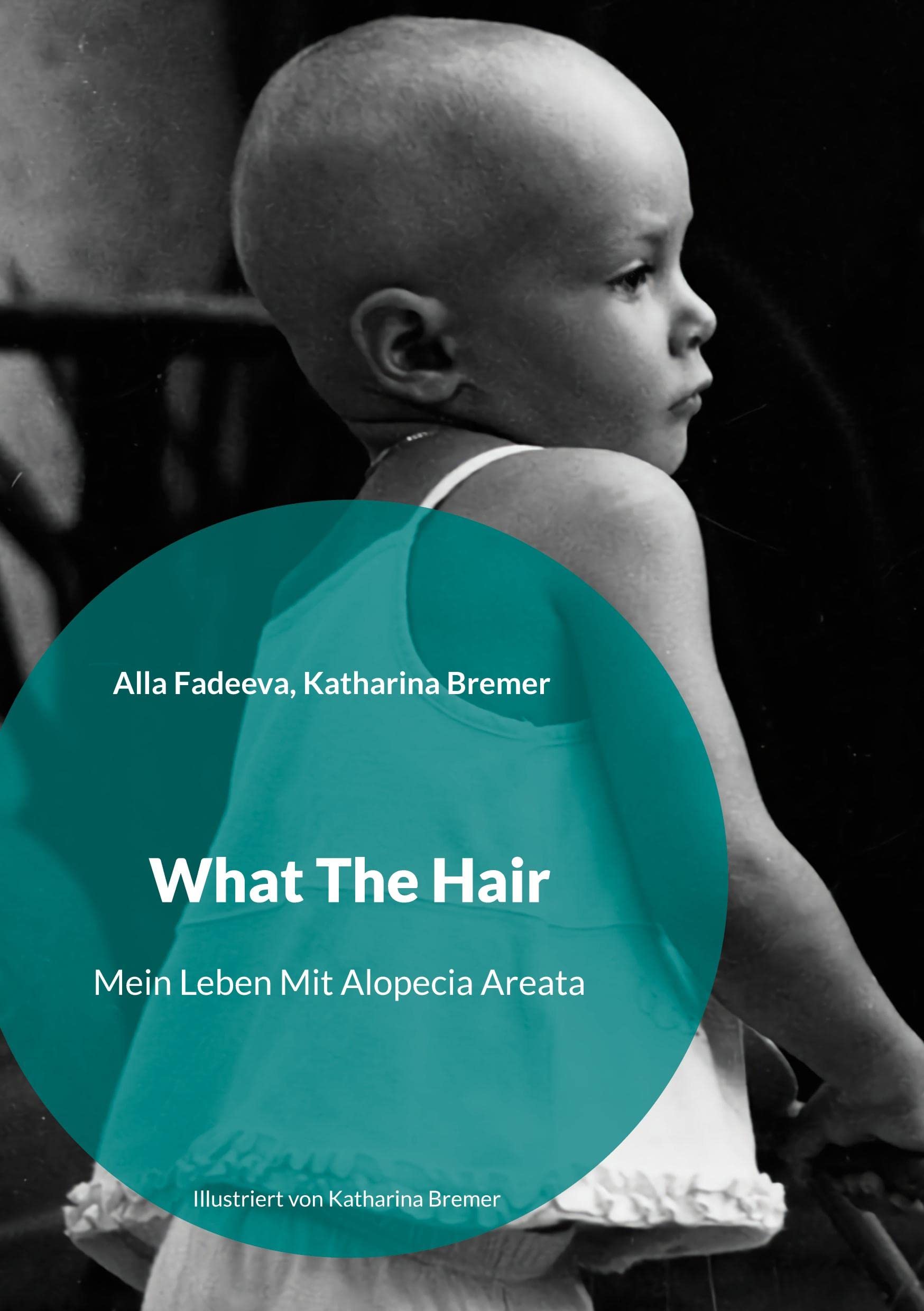 What The Hair: Mein Leben Mit Alopecia Areata Personalities