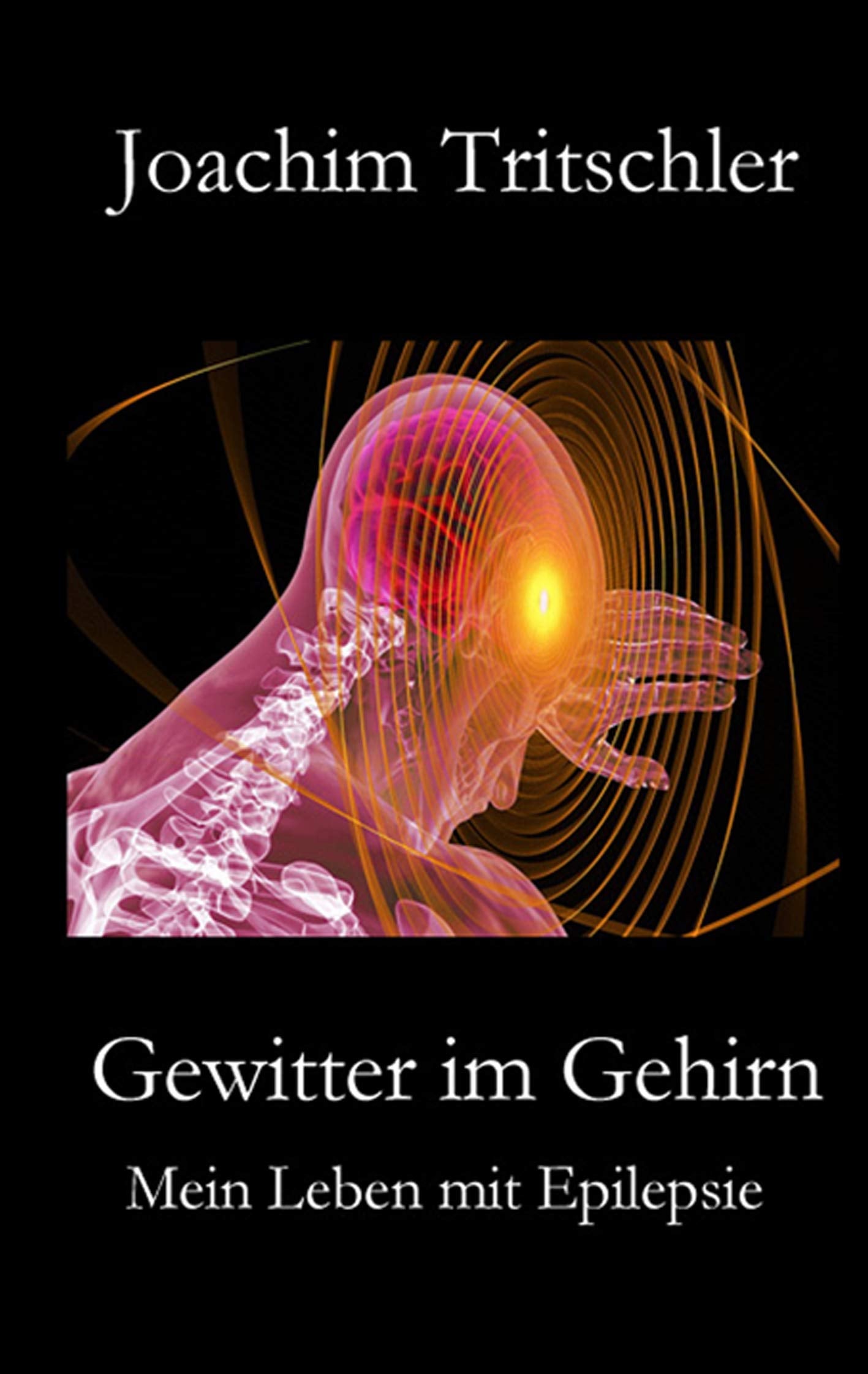 Gewitter im Gehirn: Mein Leben mit Epilepsie Medicine