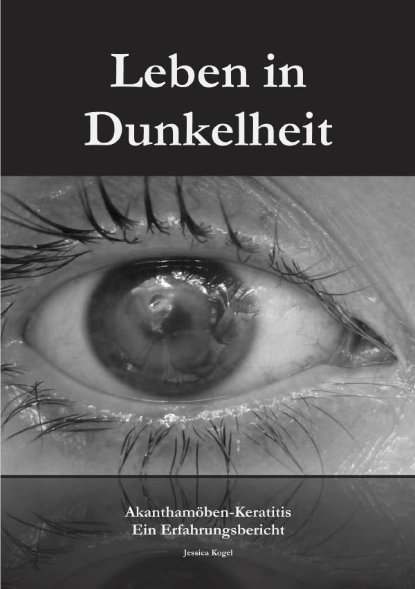 Leben in Dunkelheit - Akanthamöben-Keratitis: Ein Erfahrungsbericht Medicine
