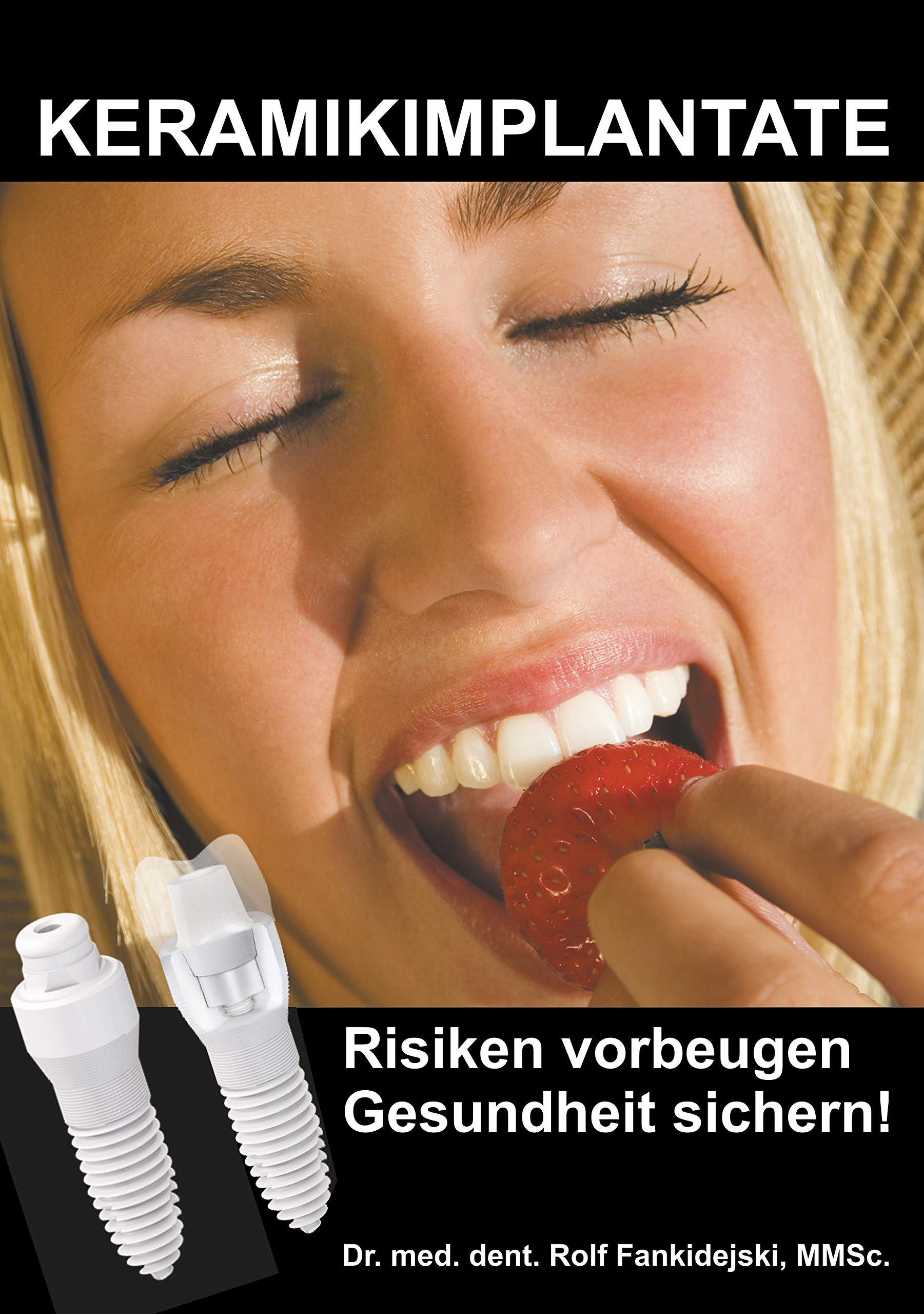 Keramikimplantate: Risiken vorbeugen, Gesundheit sichern! Medicine