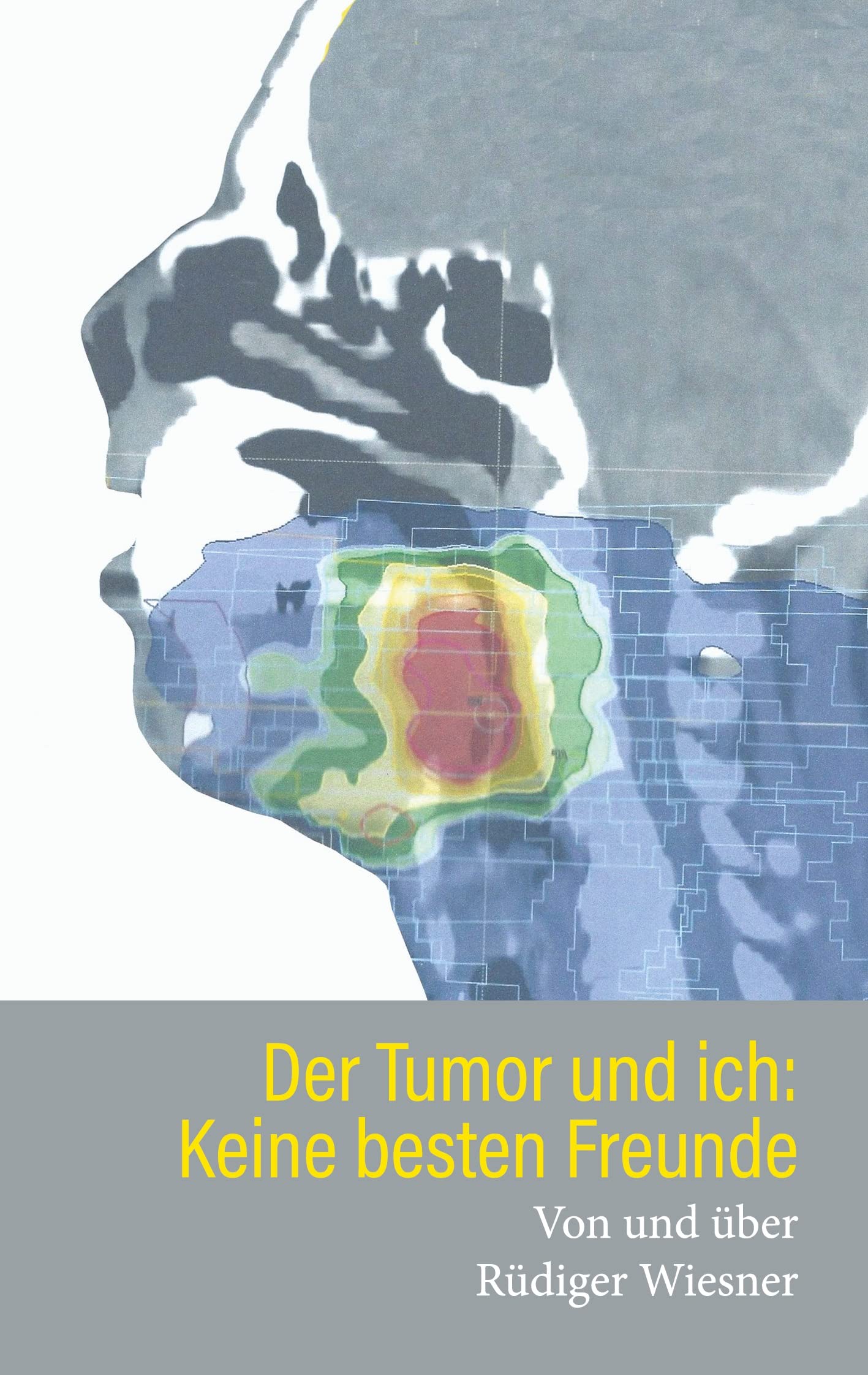 Der Tumor und Ich: Keine besten Freunde book