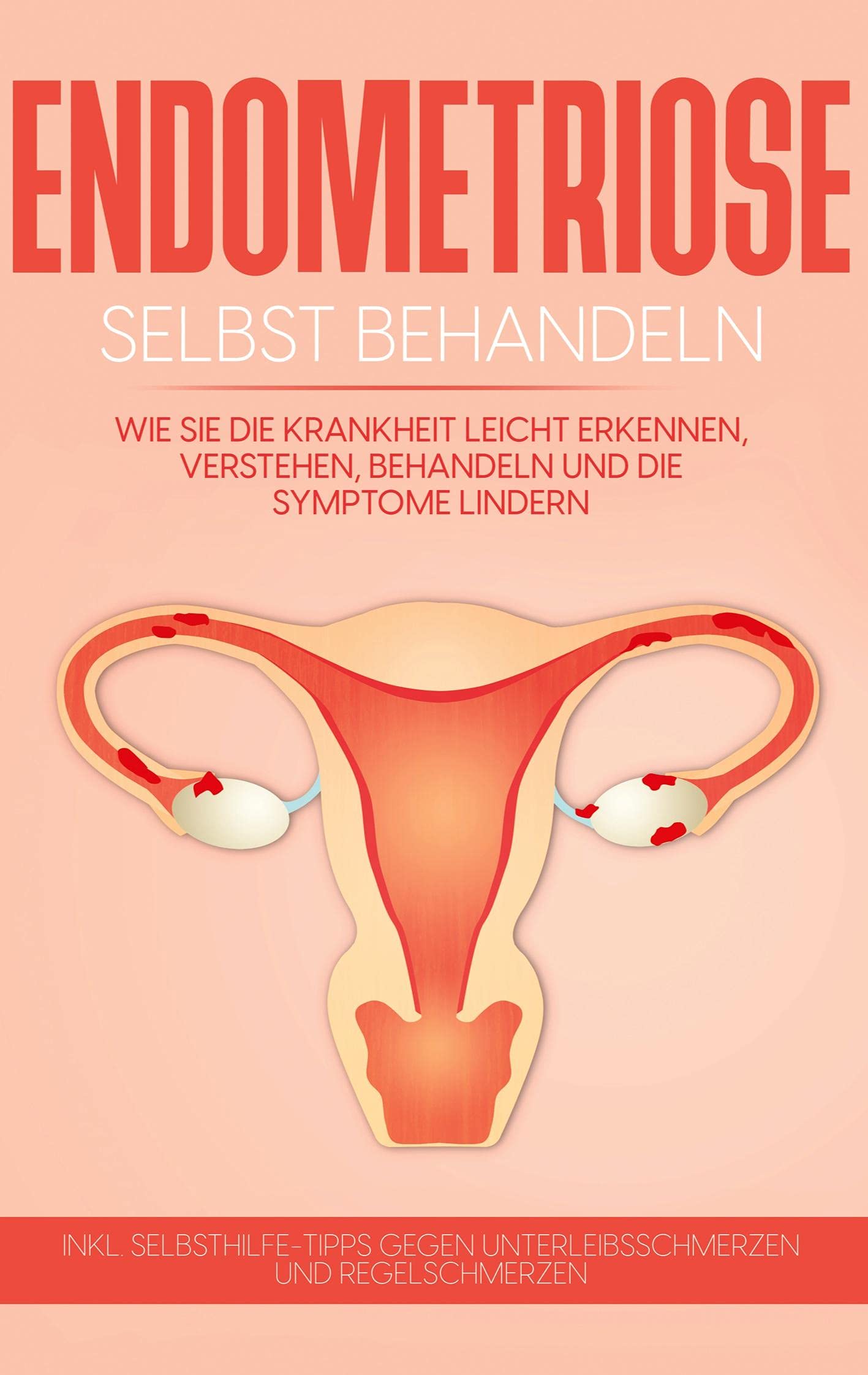 Endometriose selbst behandeln: Wie Sie die Krankheit leicht erkennen, verstehen, behandeln und die Symptome lindern - inkl. Selbsthilfe-Tipps gegen Unterleibsschmerzen und Regelschmerzen Health, Nutrition & Fitness