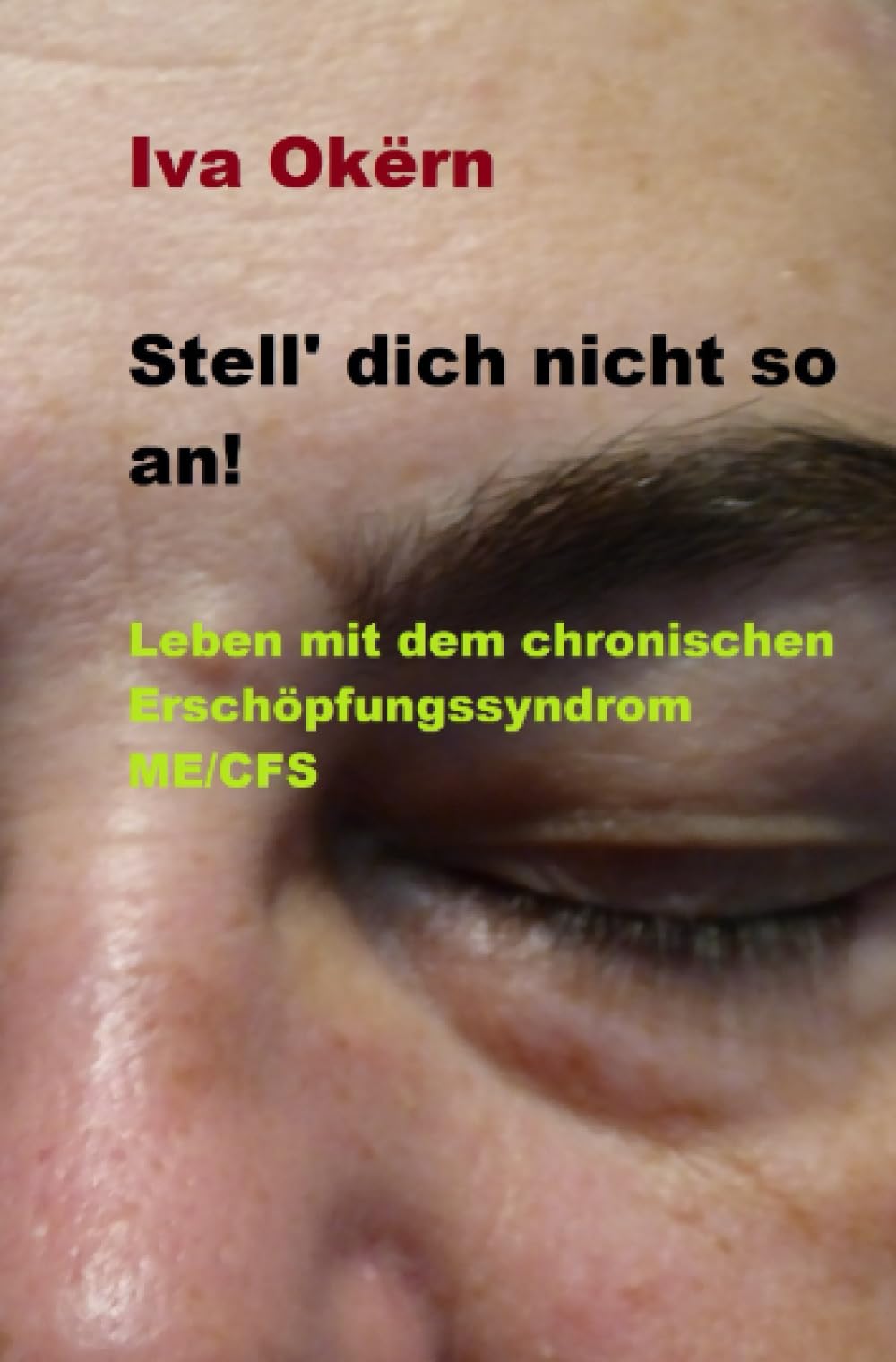 Stell dich nicht so an! Leben mit dem chronischen Erschöpfungssyndrom ME /CFS Personalities
