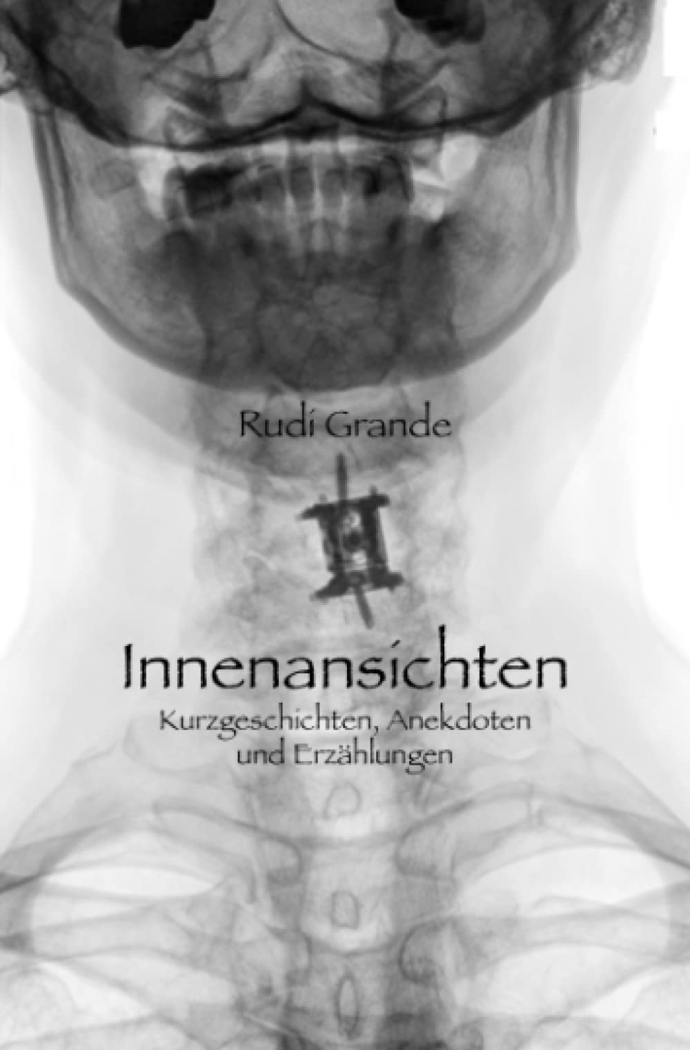 Innenansichten: Kurzgeschichten, Anekdoten und Erzählungen Contemporary literature