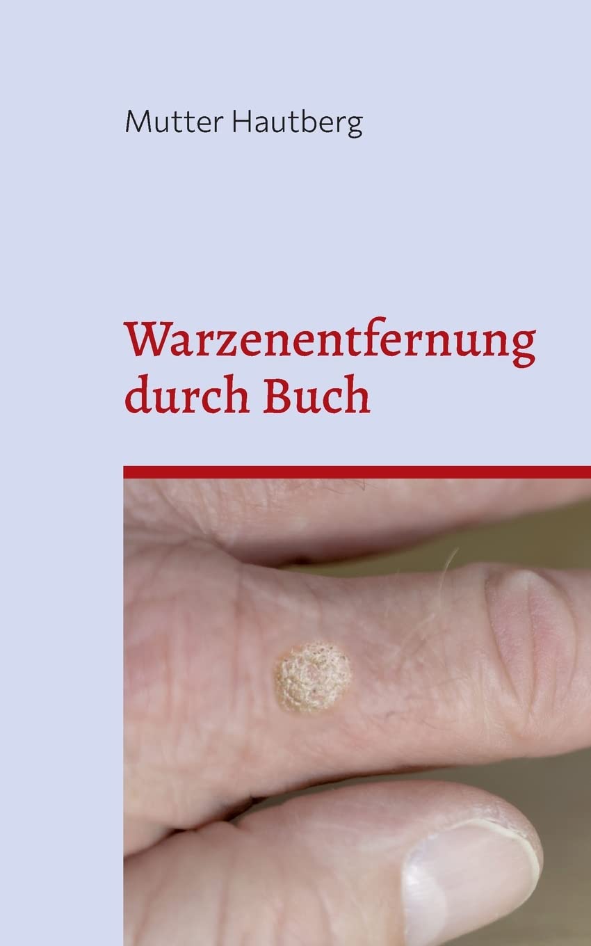 Warzenentfernung durch Buch: Heilung durch gespeicherte uralte BesprechEnergie Religion & Esotericism