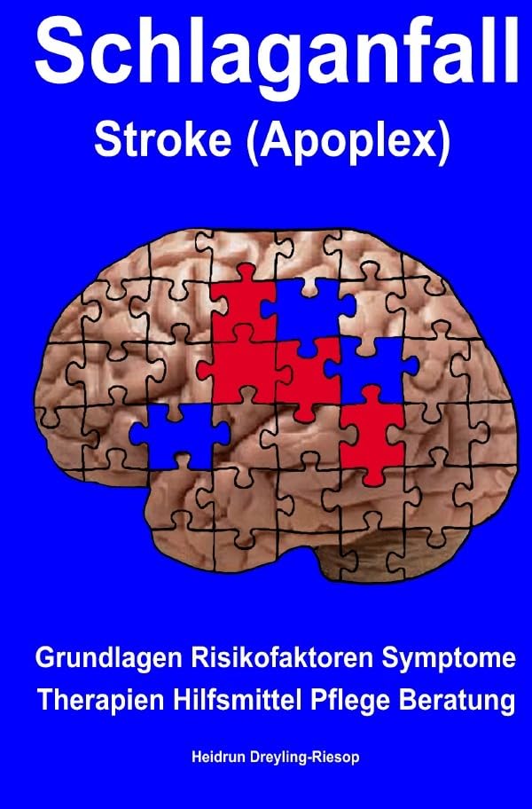 Schlaganfall Stroke (Apoplex): Grundlagen Risikofaktoren Symptome Therapien Hilfsmittel Pflege Beratung Medicine