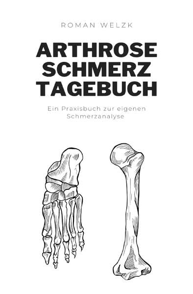 Günstiges Arthrose Schmerztagebuch: Tagebuch, Schmerzprotokoll für akute chronische Gelenkschmerzen zum ausfüllen, ankreuzen.: DE Medicine