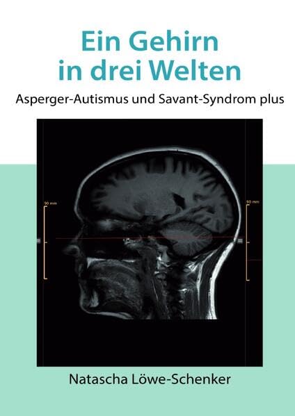 Ein Gehirn in drei Welten: Asperger-Autismus und Savant Syndrom plus Medicine
